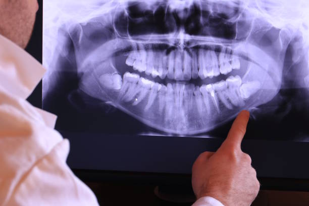Best Emergency Broken Tooth Repair in Rushford, MN